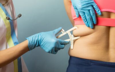 Quais são os graus de obesidade e como identificá-los?